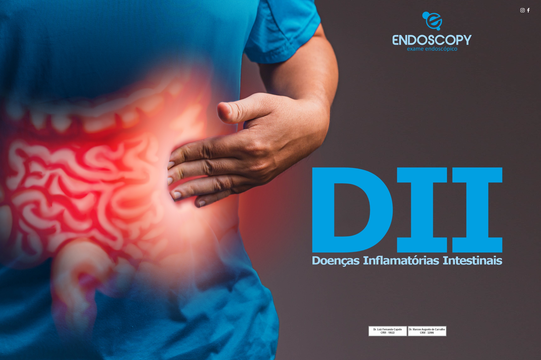 Doença de Crohn e Retocolite Ulcerativa