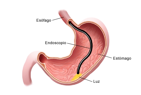 A importância da endoscopia digestiva